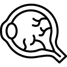 retinografía